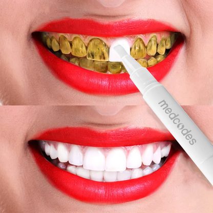 Blanchiment des dents sans fil rechargeable